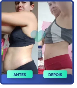 Mulher, antes e depois, com visível perda de peso na cintura e coxas, resultado do uso de Ozenvitta.