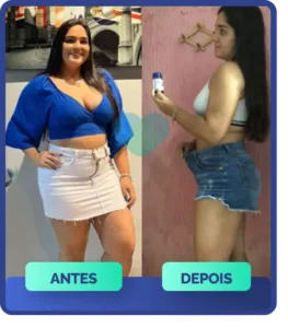 Mulher jovem, antes e depois, com calça jeans folgada, mostrando grande perda de peso e de medidas com Ozenvitta.