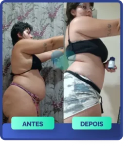 Mulher antes e depois, com notável emagrecimento em todo o corpo, alcançado com Ozenvitta.